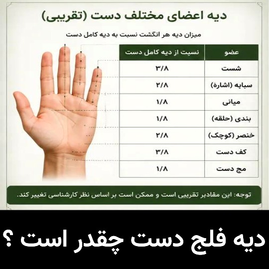 دیه فلج دست چقدر است ؟
