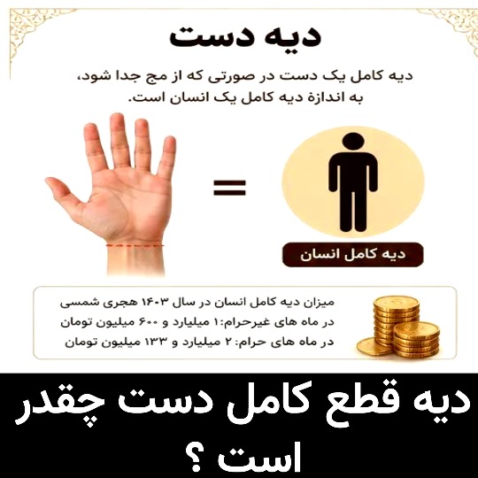 دیه قطع کامل دست چقدر است ؟