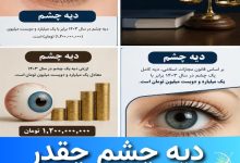 دیه چشم چقدر است ؟