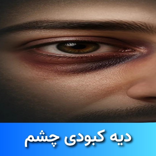 دیه کبودی چشم چقدر است ؟